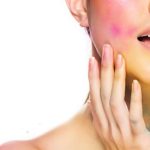 Don't let your skin turn colorless in the colors of Holi