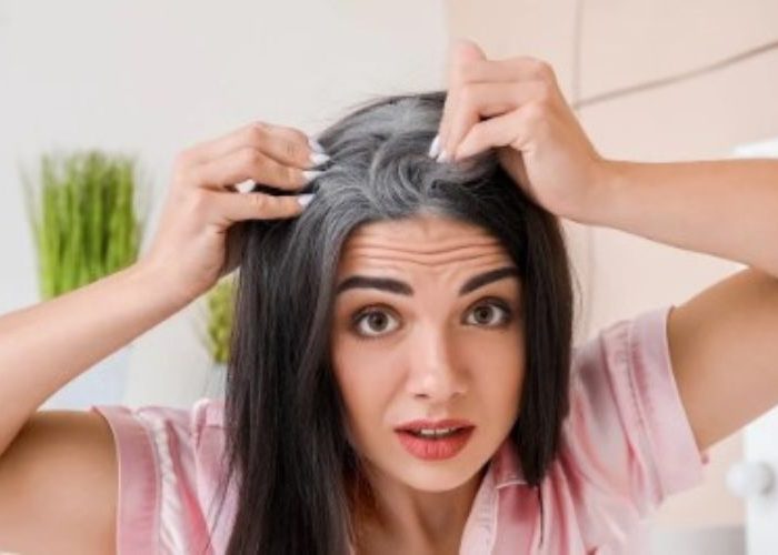 If you are troubled by white hair