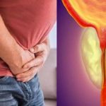 Prostate Cancer: 8 important questions related to prostate cancer in men