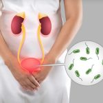 If you urinate shortly after drinking water, it could be a sign of illness