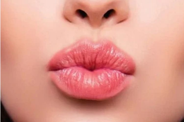 Side effects of kissing: A kiss can also become a headache